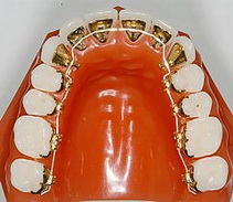 стоматология цены на брекеты